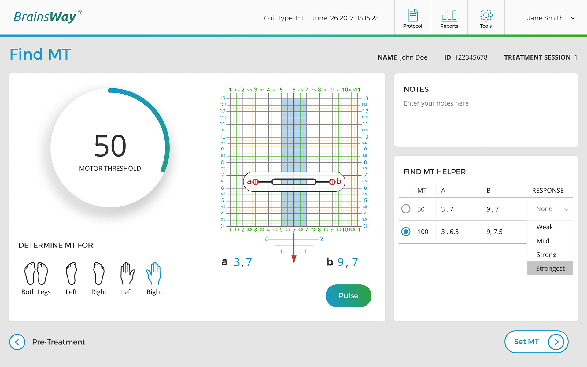 The Find MT screen, showing a motor threshold dial, a coil-position grid, and response options used to determine a patient's motor threshold.